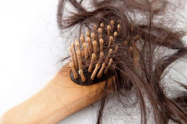 استشارى يوضح أسباب غريبة لتساقط الشعر